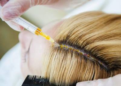 Восстановление роста волос при помощи процедуры мезотерапии