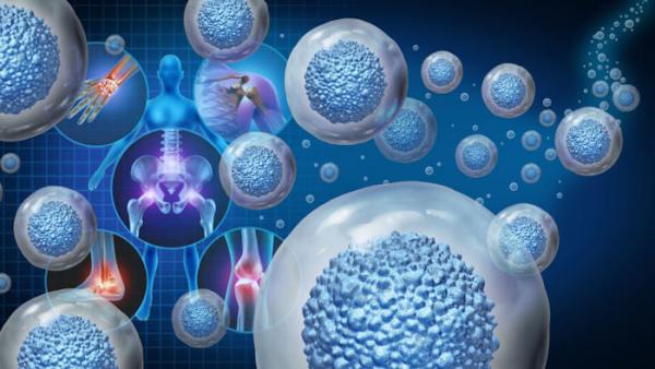Инновационная терапия стволовыми клетками: прорыв в борьбе с рассеянным склерозом
